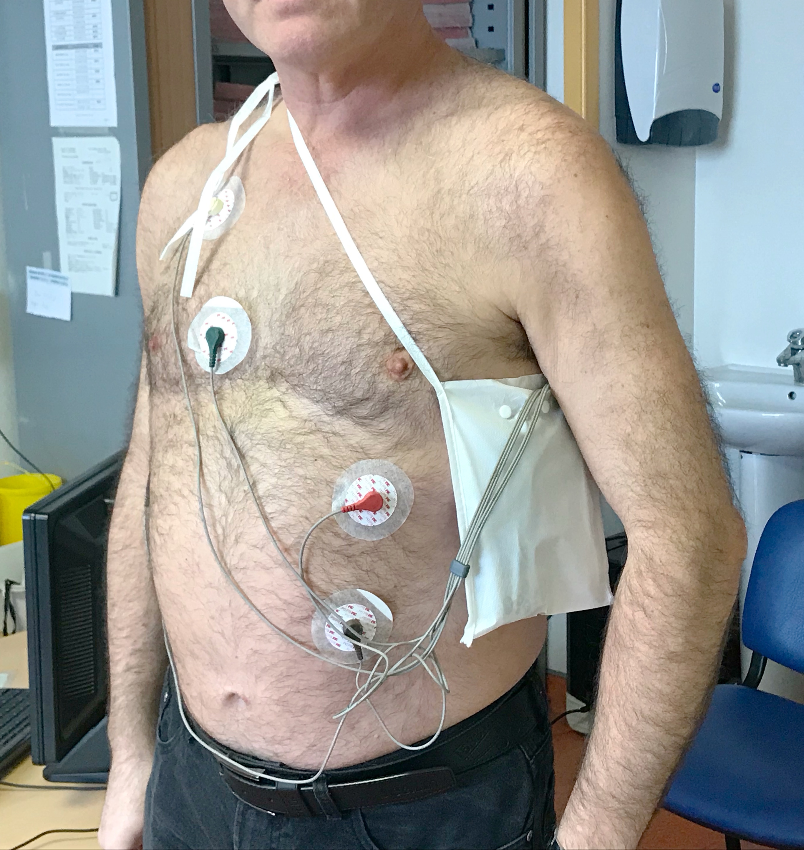 Le holter ECG - Cardiologie du CHI de Montreuil -93